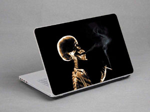 Skeleton Laptop decal Skin for TOSHIBA Satellite S50-BST2NX1 9952-503-Pattern ID:502